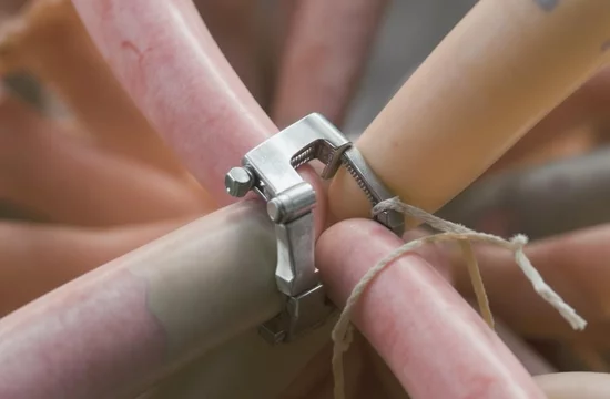 Навсегда ли «перевязка