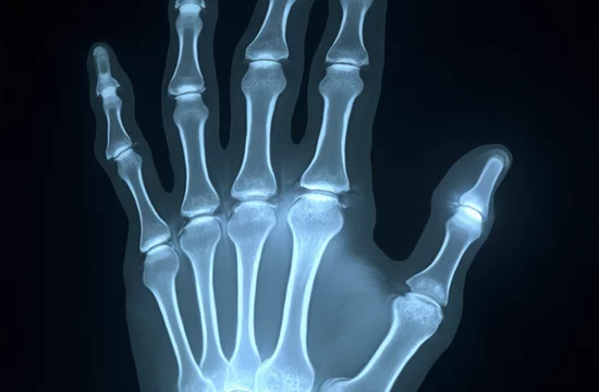 Сверхмощный рентген: прорыв